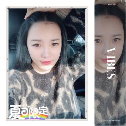 -大麦微针植发全国连锁