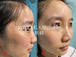 -ROYEA茹彦祛痘·问题肌肤修护中心