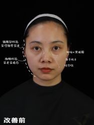 点击看大图 -Yestar重庆艺星医疗美容医院