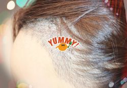 -大麦微针植发全国连锁