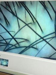 -史云逊养发护发