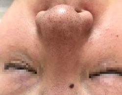 点击看大图 -Hi Beauty Skin 科技美肤中心