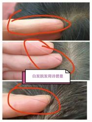 -诗碧曼养发