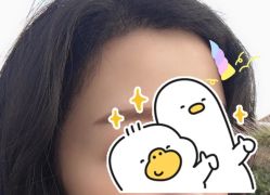 -大麦微针植发全国连锁