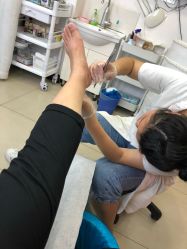 -德哥灰指甲脚气甲沟炎跖疣护理