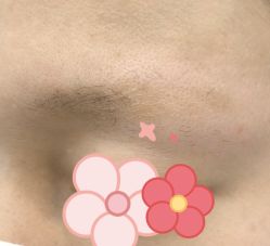 -张小野·专业半永久纹眉