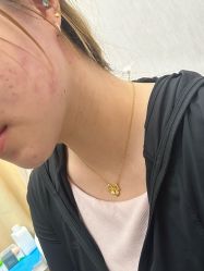 -More摩尔医美の注射线雕光电中心