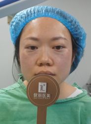 -天津健丽·去眼袋医疗美容机构