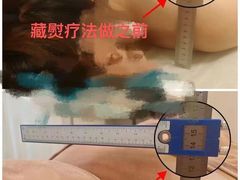 -升艾堂·经络·艾灸·气血(成山路店)
