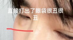 体验后-上海玫瑰医疗美容医院