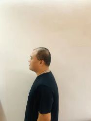 点击看大图 -极客侠男士假发定制补发