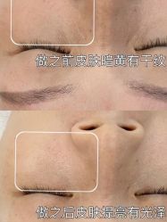 点击看大图 -美肤盾祛痘·问题肌头疗管理中心