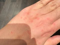 -樱桃山旅游景区