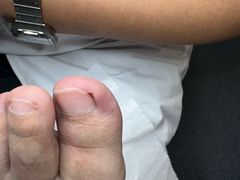 -新甲连锁灰指甲·甲沟炎·鸡眼(黑龙江路店)