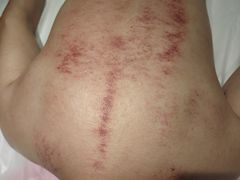 -阮氏中医推拿·颈肩腰腿(世纪公园店)