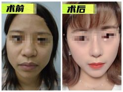 -素美医疗美容·西南眼鼻整形·修复基地