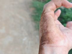 -长虫山生态公园风景林