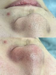 -SKIN79皮肤管理中心