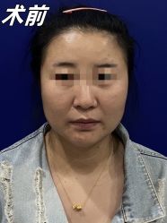 -素美医疗美容·西南眼鼻整形·修复基地
