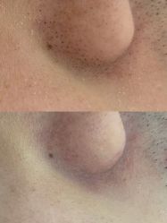 点击看大图 -蕾特恩专业祛痘·皮肤管理