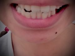 -深圳佑诺口腔门诊部