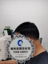 -唐风采假发补发定制
