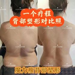 点击看大图 -Lily纤美·科技减脂中心