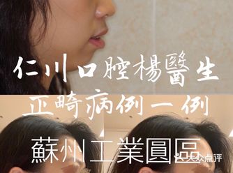 仁川口腔楊醫生矫正病例展示