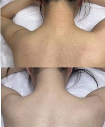 -玉笙美肤·专业脱毛中心
