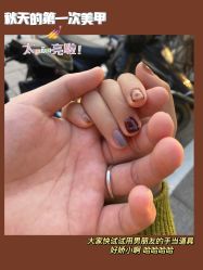 -U-Nail