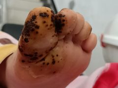 -新甲连锁灰指甲·甲沟炎·鸡眼(黑龙江路店)