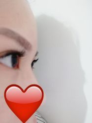 -初樱科技美学问题肌修复中心