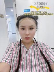 -雍禾植发