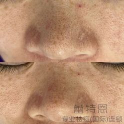 点击看大图 -蕾特恩专业祛痘·皮肤管理