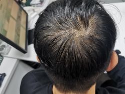 -章光101防脱养发荟
