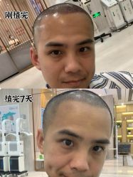 -雍禾植发全国连锁