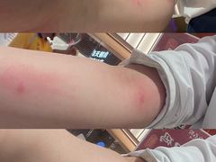 -复旦大学附属华山医院(总院)