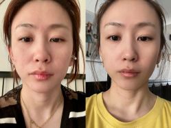 -上海伊莱美医疗美容医院