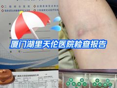 -厦门湖里天伦医院-体检中心