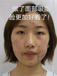 -深圳艺星医疗美容医院