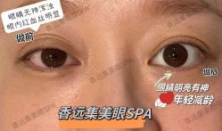-雅曼妮spa美容养生