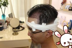 -大麦微针植发丨全国连锁