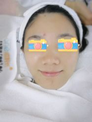 -痘院长·祛痘·皮肤管理