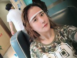 点击看大图 -大麦微针植发丨全国连锁