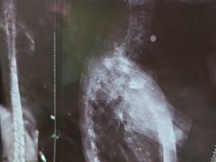 -张钰强中医正骨推拿连锁(华发商都店)