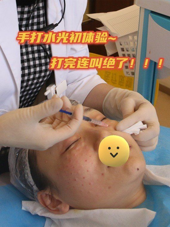 手打水光初体验,打完连叫绝了!