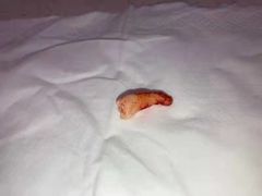 -牙易美口腔(圣堂店)