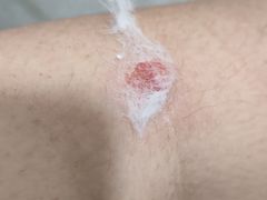 -浙江省中医院(湖滨院区)