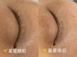 点击看大图 -skin79皮肤管理中心