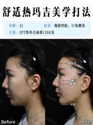 -深圳艺星医疗美容医院